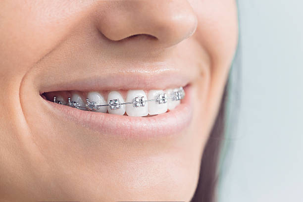 Best Traditional Braces  in Minneola, FL